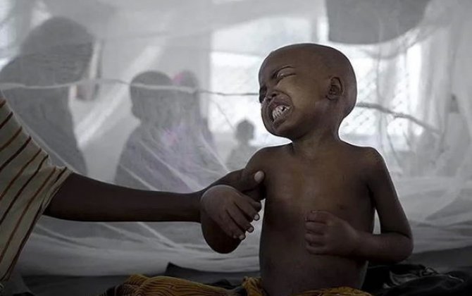 UNICEF: “Afrika ölkələrində vəba epidemiyası sürətlə yayılır”