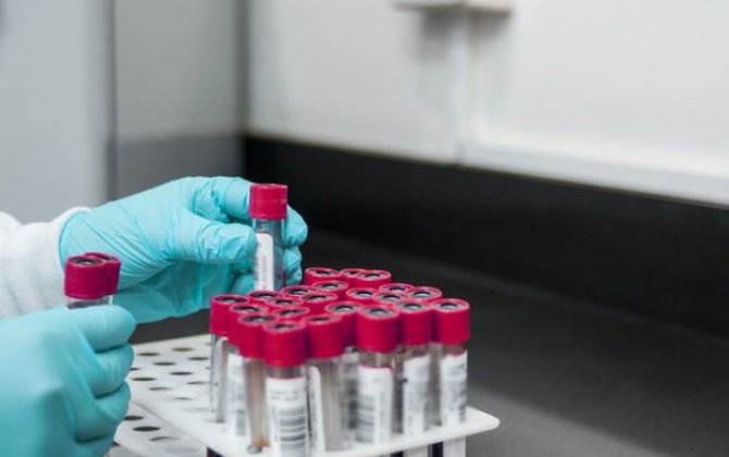 Dünyada altıncı xəstədə İİV infeksiyasının azalması qeydə alınıb