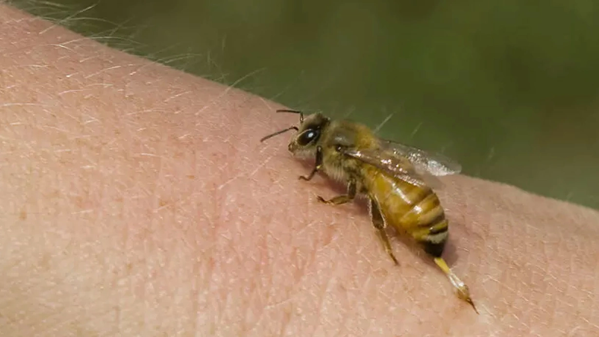 Arının sancdığı adam həyatını itirdi