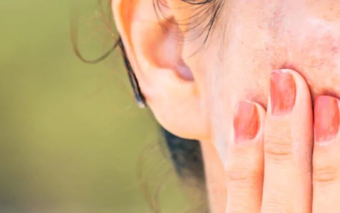 Nədən dəridə piqment ləkələri yaranır və onlarla necə davranmaq lazımdır? - FOTO