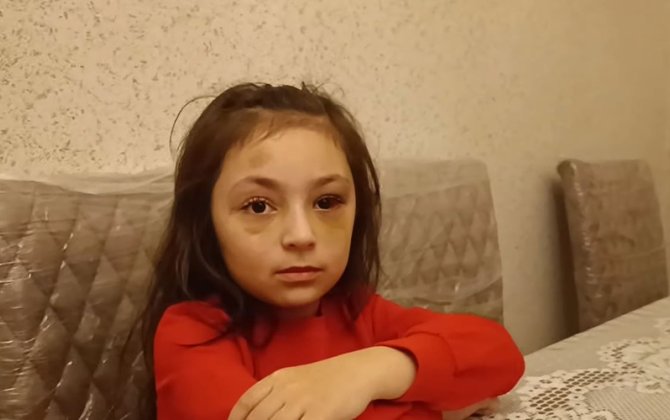 “Direktor maddiyyatla həll etmək istəyirdi” – Döyüldüyü deyilən məktəblinin ANASI + VİDEO