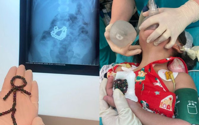 Bakıda qorxunc hadisə -xa0dörd yaşlı uşaq 53...