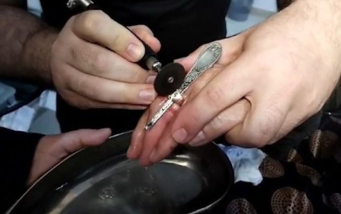 Bakıda barmağına üzük sıxışan yaşlı qadının köməyinə FHN çatdı - VİDEO