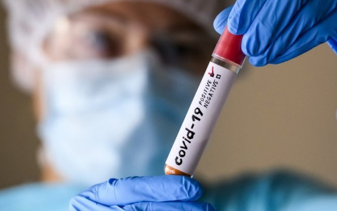 В Азербайджане выросло число случаев заражения коронавирусом - ФОТО