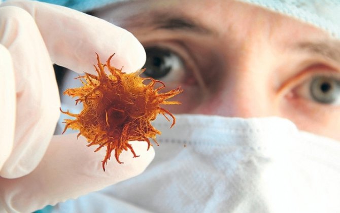 Xərçəngdən öləcəkdi: qeyri-adi müalicədən sonra sağaldı