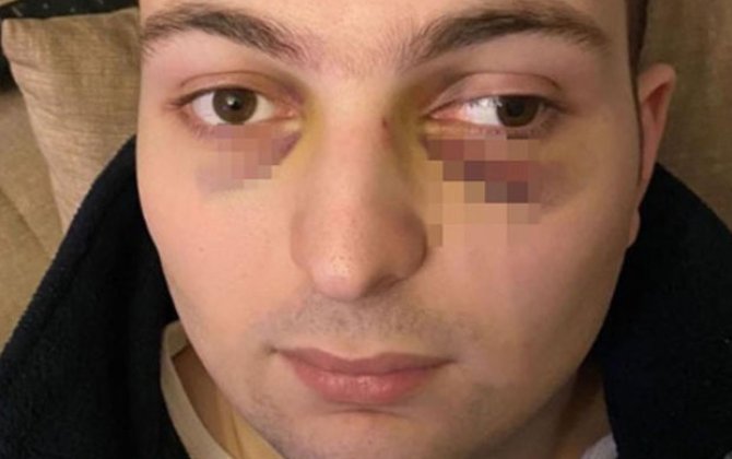 Ticarət mərkəzində döyülən oğlanla bağlı araşdırma başladı