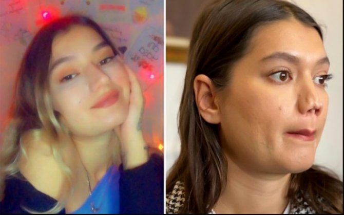 Burnu çürüyən qız həkimdən 1 milyon təzminat tələb edir - FOTO