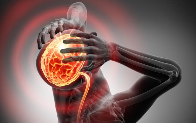 Baş ağrılarını kəsən  5 ən effektiv üsul