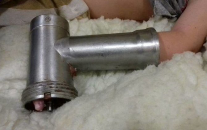 В Лянкяранском районе пальцы 13-летней девочки застряли в мясорубке