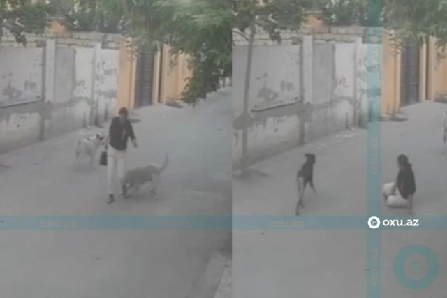 Жительница Хырдалана подверглась нападению бродячей собаки