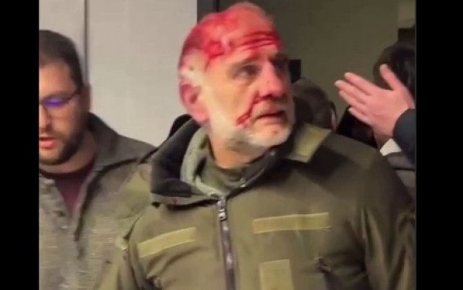 Gürcüstan paytaxtında qan töküldü...-FOTO