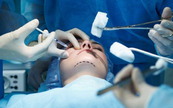 Diplomsuz plastik cərrahlarla bağlı 18 FAKT AŞKAR EDİLDİ - RƏSMİ