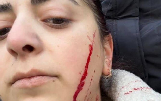 Gürcüstanda iqtidar tərəfdarı müəlliməni avropapərəst mövqeyinə görə bıçaqladı...-FOTO