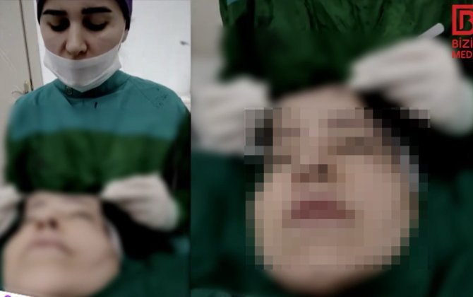 Xəstənin dərisini əlində tutan cərrah canlı yayım AÇDI – ANBAAN VİDEO