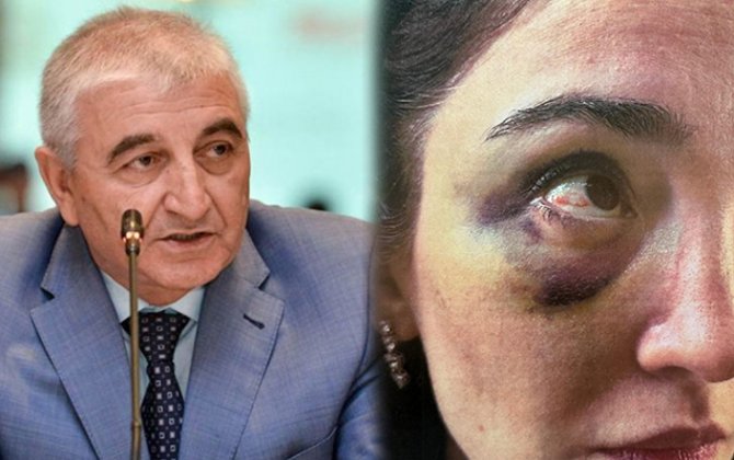 Məzahir Pənahovun oğlu arvadınaxa0işgəncə verib - FOTO