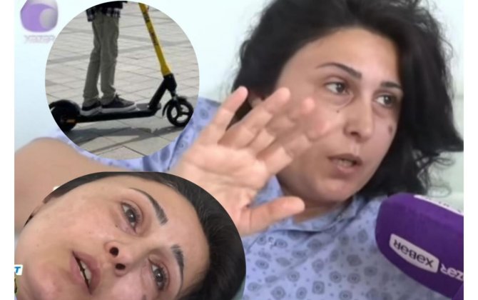 “Həmin şəxsin cəza çəkməsini istəmirəm, bilərəkdən etməyib”-skuterin vurduğu aktrisa-ÖZƏL+FOTO