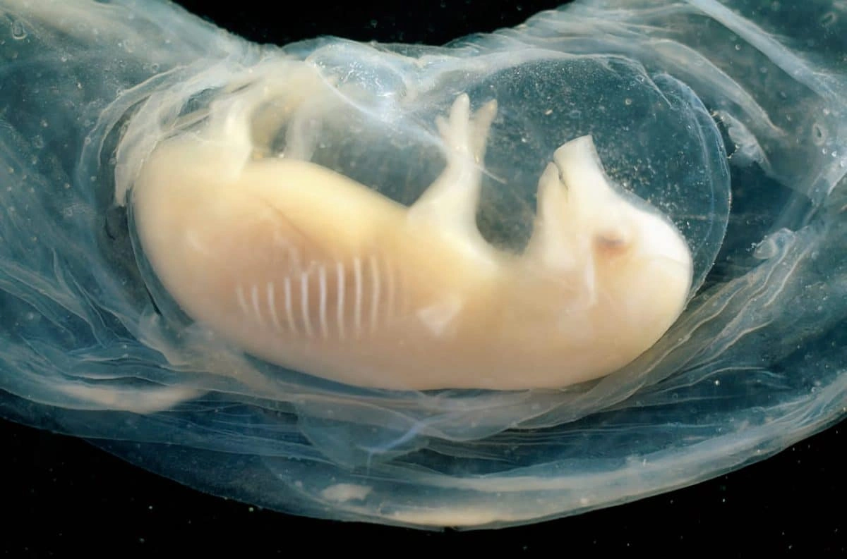 Çin alimləri ilk dəfə donuz embrionunda insan ürəyi yetişdirdilər