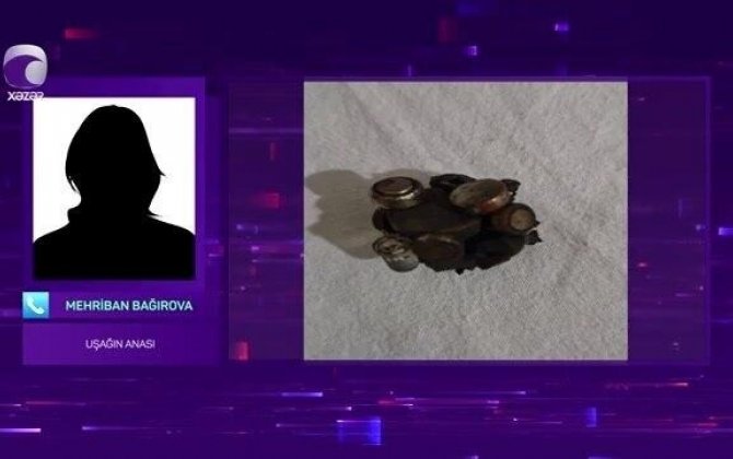 Batareya və maqnit qırıntıları udan 10 yaşlı uşağın anası DANIŞDI - VİDEO