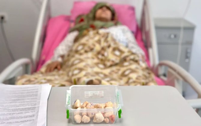 15 ildir gəzə bilmirdi, dizindən 25 daşlaşmış şiş çıxarıldı - FOTO