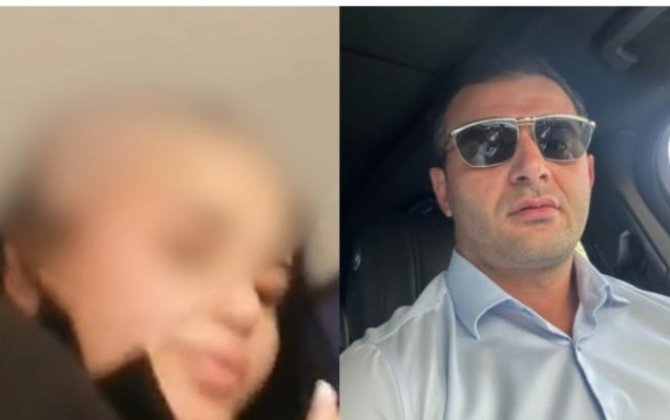 Həyat yoldaşının başını keçəl edən şəxs saxlanıldı