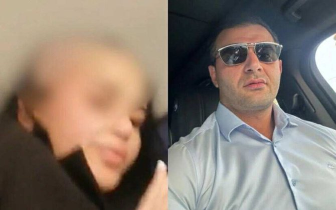 Arvadının saçını keçəl qırxan ər HƏBS OLUNDU