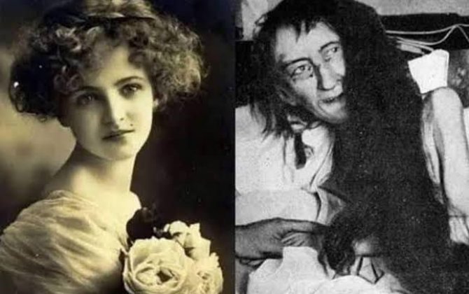 Anasının 25 il otaqda zəncirlədiyi qadının dəhşətli heyakəsi