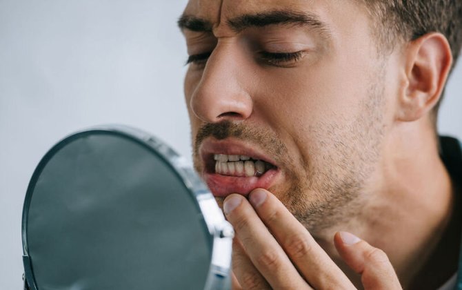 Hansı qidalar dişləri daha çox ləkələyir? - Stomatoloq AÇIQLADI