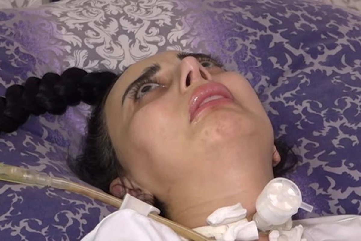 Burun əməliyyatına sağlam girib iflic olaraq çıxdı: Cərrah isə aparatın işləmədiyini deyir