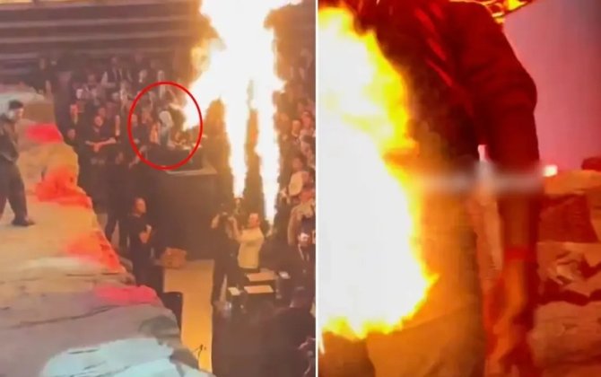 Məşhur sənətçinin konsertində kabus dolu anlar: qəfildən yandı - FOTO