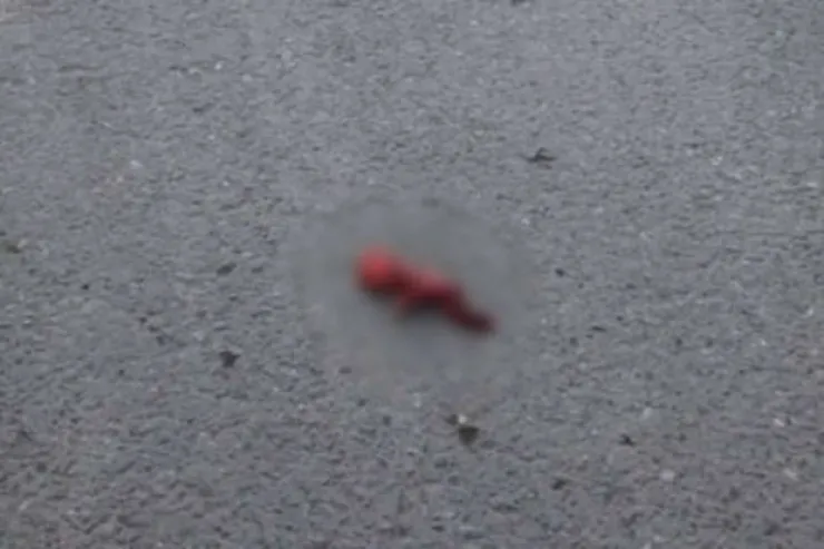 Bakıda xəstəxananın həyətindən döl TAPILDI