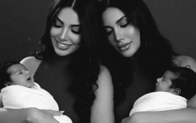 Sevillə Sevinc süni intellektlə “ana oldu” - FOTO