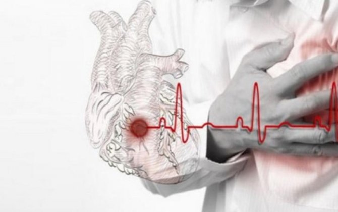 “Səssiz” gəlib qəfil aparan ölümlər - Genetik amil, yoxsa...