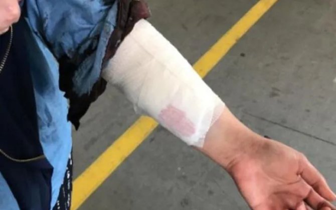 Salyanda kişi qısqanc sevgilisini döyüb dişlədi