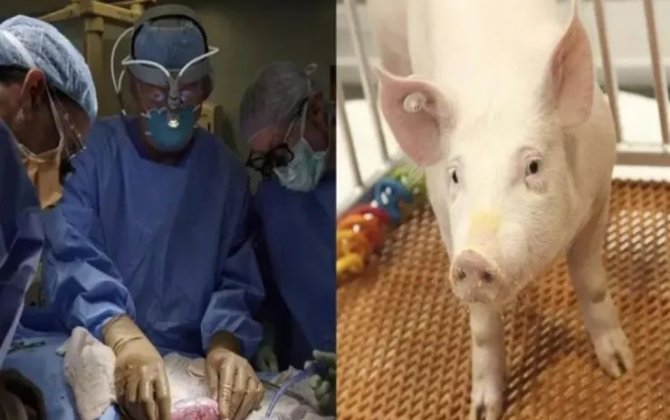 60 gündən çoxdur donuz böyrəyi ilə yaşayır