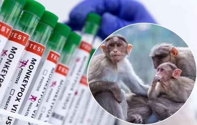 В Израиле зарегистрирован первый случай заражения агрессивным штаммом оспы обезьян