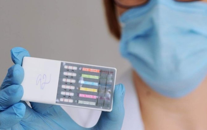 Elçiliyə narko-testlə gediləcək? Kürəkən olmaq istəyənlər üçün yeni dövr başlayır