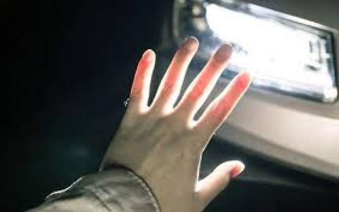 В Саатлы автомобиль насмерть сбил мужчину