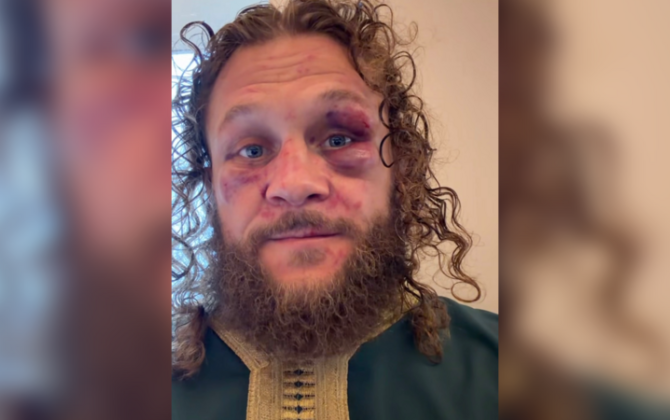 Rafael Fiziyevdən məğlubiyyət şərhi: “Yaxşıca döyüldüm, amma geri qayıdacağam”