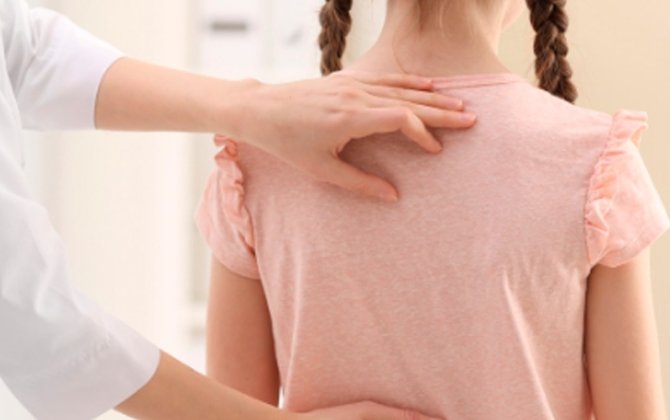 Uşaqlarda skoliozu necə müəyyən edək? - Radioloqla müsahibə