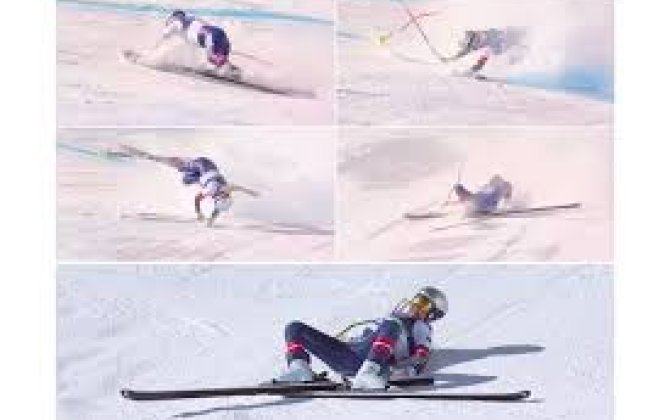 Американская горнолыжница получила тяжелую травму на Олимпиаде