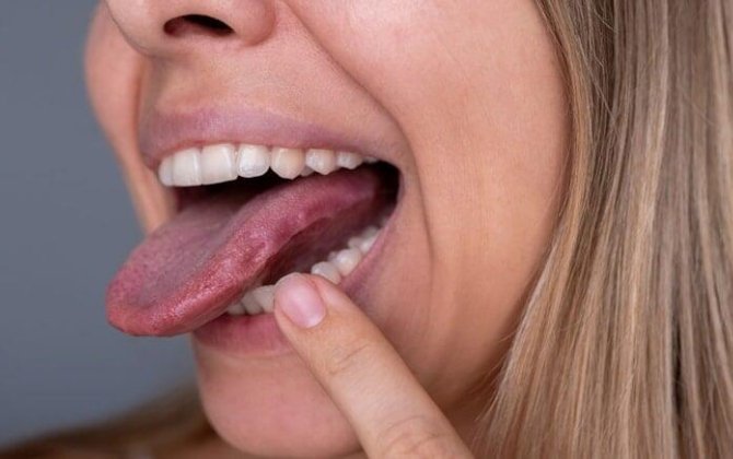 Niyə dilimizi təsadüfən dişləyəndə ağrıyır, amma bilərəkdən dişləyəndə yox?