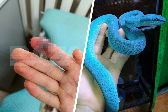 В Москве врачи спасли подростка после укуса ядовитой змеи