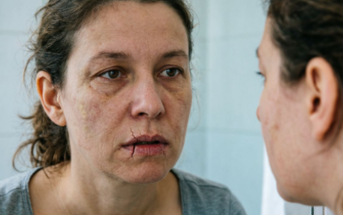 Qışdan çıxan bədəndə nə çatışmır? – Orqanizmin gizli siqnalları