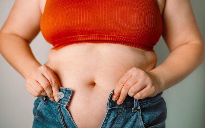 Как худеть, чтобы не обвисала кожа? - Советы тренера