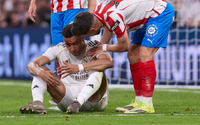 Mbappe zədəsinə görə məşqi buraxdı