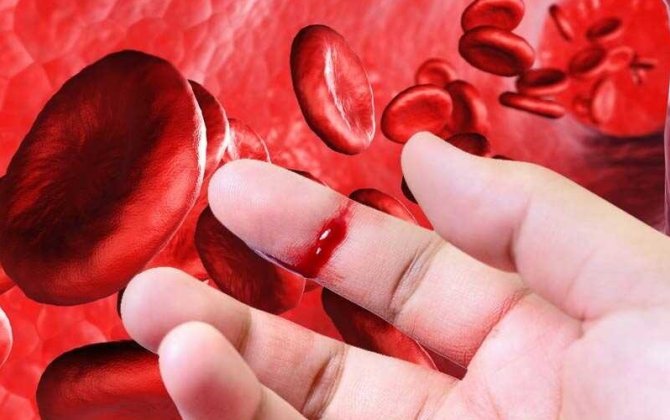 “Hemofiliya: irsi xəstəlik yoxsa idarə oluna bilən vəziyyət?” - Ekspert açıqladı