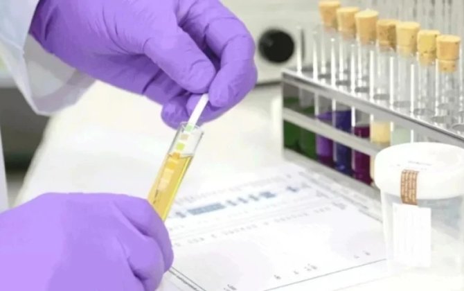 Bu sənəd olmadan artıq işə qəbul ola BİLMƏYƏCƏKSİNİZ