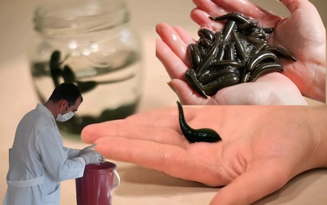 “Azərbaycanda zəli tükənir, ovlanmasına qadağa qoyulsun, bizdə 2 manat, xaricdə 20 avrodur” - FOTO+ÖZƏL