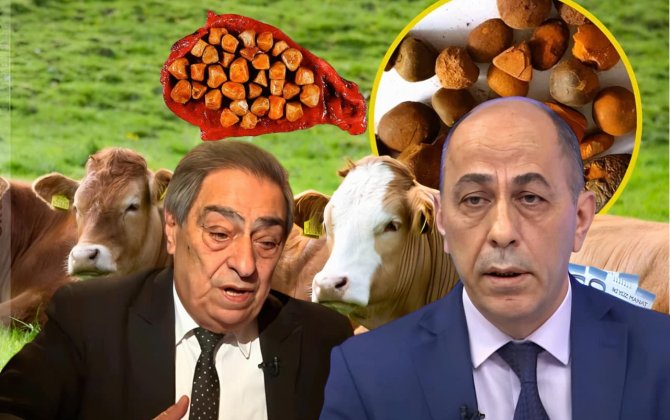 Qızıl qiymətinə satılan inəyin öd daşı iki həkimi üz-üzə qoydu: “Bu cəfəngiyyatdır, bizim millət falçıya da inanır” - FOTO+ÖZƏL