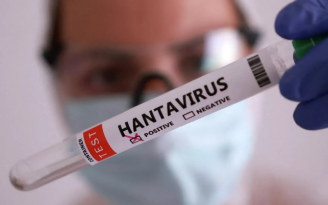 Təşvişə qapılmadan sadə gigiyena qaydalarına əməl etmək lazımdır - Həkim hantavirusla bağlı iddialara aydınlıq gətirdi